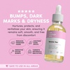 Her Fantasy Box | Bright & Even Skin Kit – Turmeric Vitamin C Body Wash, Sensitive Probiotic Wash, Renew Her Oil & Pineapple Crème Body Oil for Soft, Glowing Skin