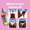 Her Fantasy Box Renew Her | Natural Rejuvenating Yoni Oil for Dark Spots, Ingrown Hair, and Skin Brightening – Nourishing, Moisturizing Formula for All Skin Types(2 Fl Oz (Pack of 1))