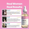 Her Fantasy Box Renew Her | Natural Rejuvenating Yoni Oil for Dark Spots, Ingrown Hair, and Skin Brightening – Nourishing, Moisturizing Formula for All Skin Types(2 Fl Oz (Pack of 1))